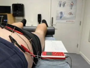 Akupunkturbehandling med elektrisk stimulation på lår og ben for smertelindring.